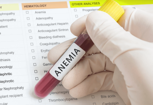 Como diagnosticar a anemia?