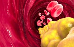 Imagem ilustrando glóbulos vermelhos e gorduras nas correntes sanguíneas