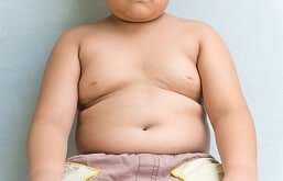 Imagem de uma criança sobre obesidade infantil