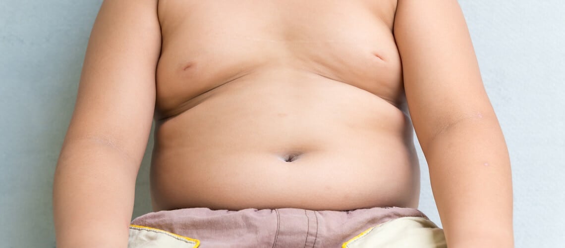 Imagem de uma criança sobre obesidade infantil