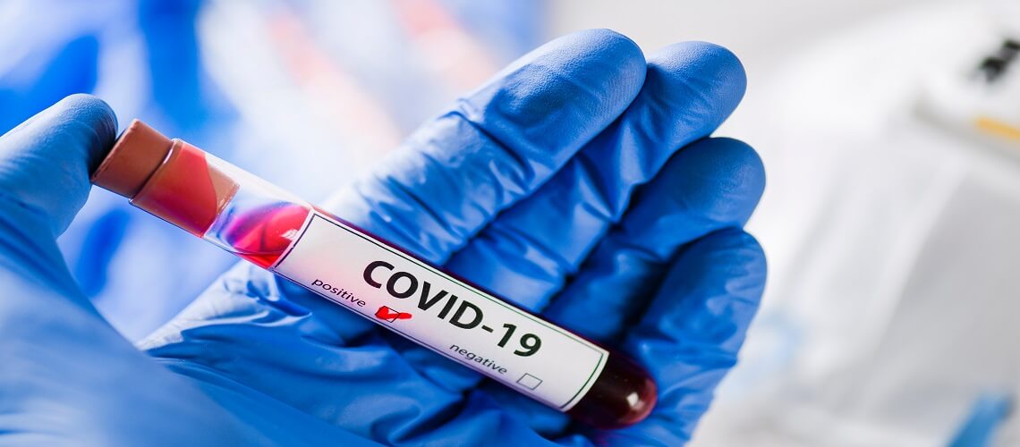 deficiência de zinco e selênio aumenta morte por COVID-19