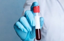 médico segurando amostra de sangue
