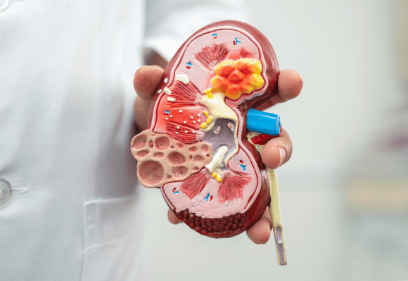 Diretrizes práticas para acompanhamento da doença renal crônica