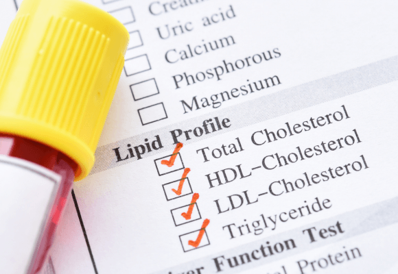 tratamento das dislipidemias