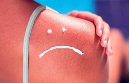 Pessoa com o ombro queimado e uma smile triste feita com filtro solar